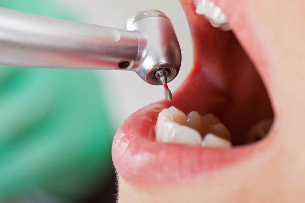 Best Urgent Tooth Repair  in East Dundee, IL